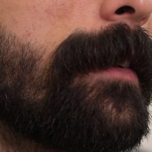 تجارب زيت الحشيش للذقن