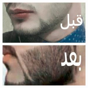 زيت الحشيش الافغاني للذقن