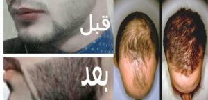 زيت الحشيش الافغاني للذقن