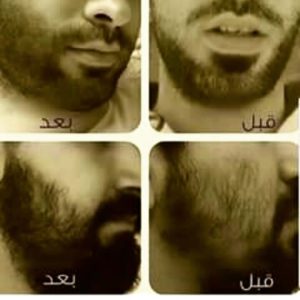 زيت الحشيش للذقن