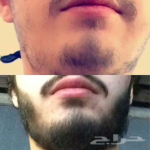 فوائد زيت الحشيش للذقن