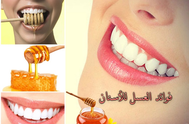 فوائد العسل للاسنان