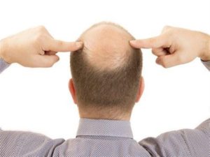 حبوب لمنع تساقط الشعر وتقويته