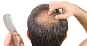 عشبه تمنع تساقط الشعر