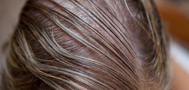 علاج الشعر الخفيف وراثيا