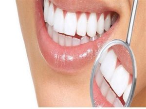 اسعار تلبيس الاسنان الزيركون في تركيا