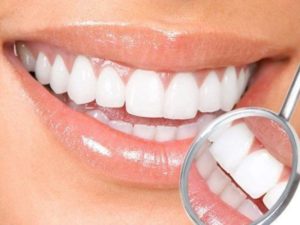 تجميل الاسنان الاماميه بدون تقويم