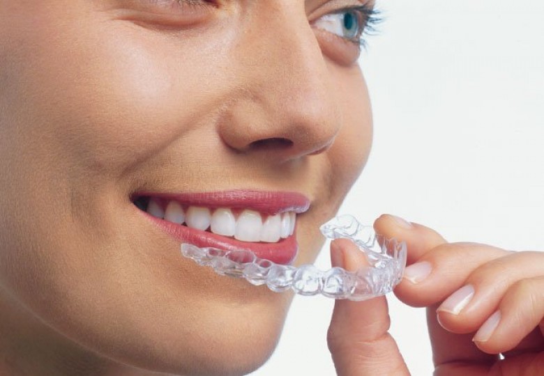 تركيب تقويم الاسنان في تركيا