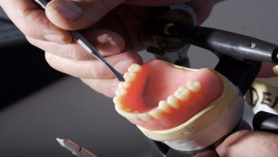 تكلفة زراعة الاسنان الفورية في تركيا