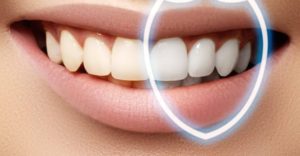 طريقة تركيب ابتسامة هوليود