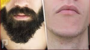 طريقة استخدام زيت الحشيش للشنب 0540428830 مدينة الرياض