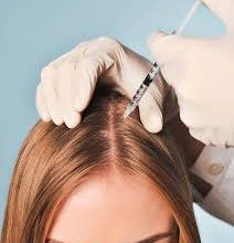 تجارب علاج الشعر