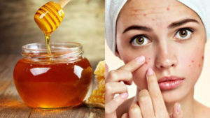 فوائد استخدام العسل للمهبل
