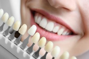 افضل دكتور اسنان في تركيا اسطنبول