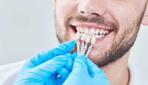 مراكز تجميل الاسنان في أسطنبول